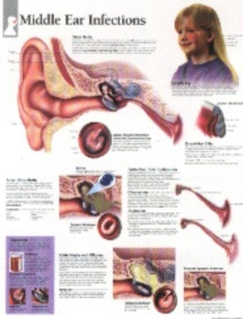 Book cover of: Middle Ear Infections Paper Poster. By: Scientific Publishing
