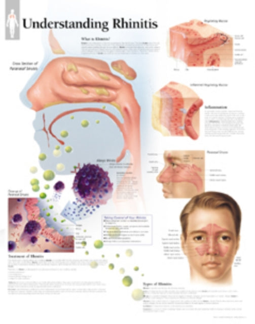 Book cover of: Understanding Rhinitis Paper Poster. By: Scientific Publishing