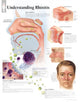 Book cover of: Understanding Rhinitis Paper Poster. By: Scientific Publishing