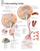 Book cover of: Understanding Stroke Paper Poster. By: Scientific Publishing