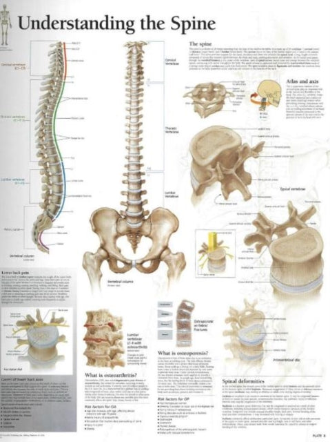 Book cover of: Understanding the Spine Laminated Poster