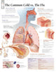 Book cover of: Common Cold vs the Flu Laminated Poster. By: Scientific Publishing