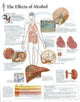 Book cover of: Effects of Alcohol Laminated Poster