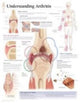 Book cover of: Understanding Arthritis Paper Poster. By: Scientific Publishing