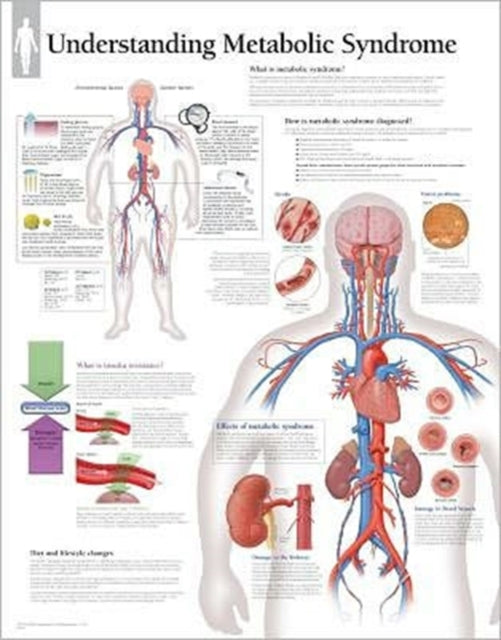 Book cover of: Understanding Metabolic Syndrome Laminated Poster