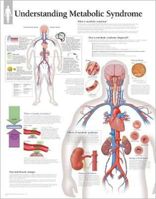 Book cover of: Understanding Metabolic Syndrome Paper Poster