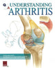 Book cover of: Understanding Arthritis Flip Chart. By: Scientific Publishing Ltd.