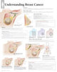Book cover of: Understanding Breast Cancer Laminated Poster