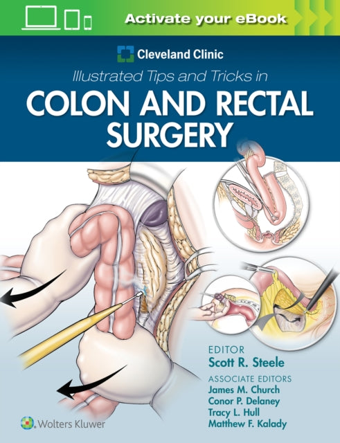 Book cover of: Cleveland Clinic Illustrated Tips and Tricks in Colon and Rectal Surgery. By: Steele