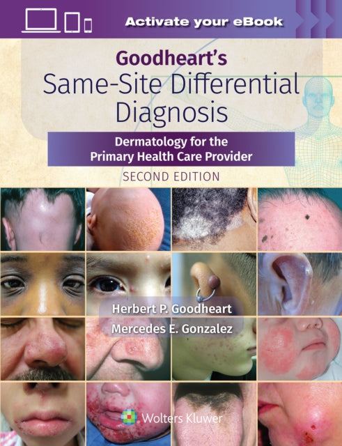 Book cover of: Goodheart's Same-Site Differential Diagnosis. By: Herbert Goodheart