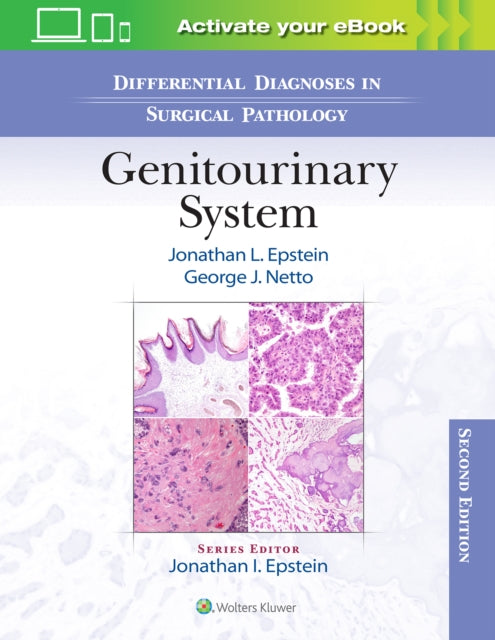 Book cover of: Differential Diagnoses in Surgical Pathology: Genitourinary System. By: Jonathan Epstein