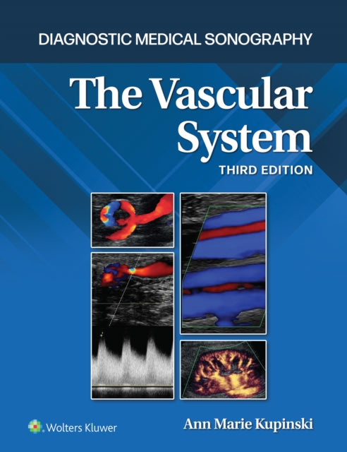 Book cover of: Vascular System. By: Ann Marie Kupinski