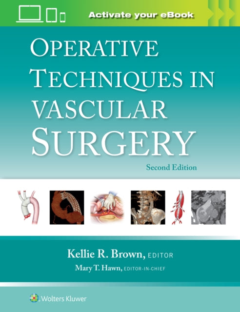 Book cover of: Operative Techniques in Vascular Surgery: Print + eBook with Multimedia. By: Kellie R. Brown