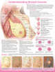Book cover of: Understanding Breast Cancer Anatomical Chart