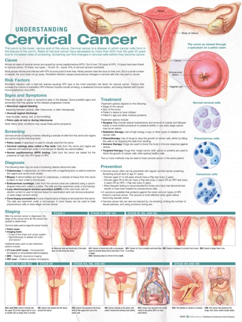Book cover of: Understanding Cervical Cancer Anatomical Chart
