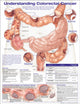 Book cover of: Understanding Colorectal  Cancer Anatomical Chart