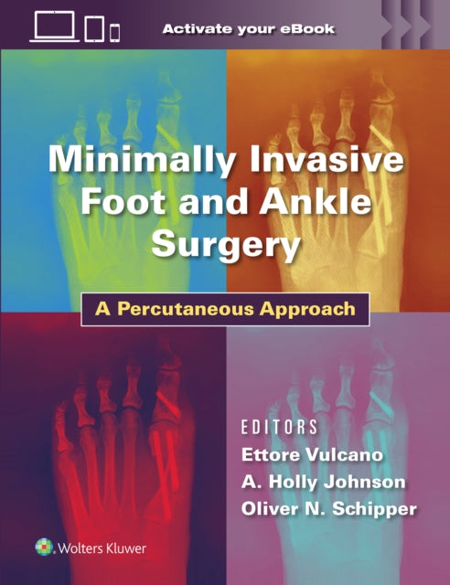 Book cover of: Minimally Invasive Foot and Ankle Surgery. By: Ettore Vulcano