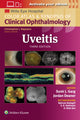 Book cover of: Uveitis. By: Sunir J. Garg