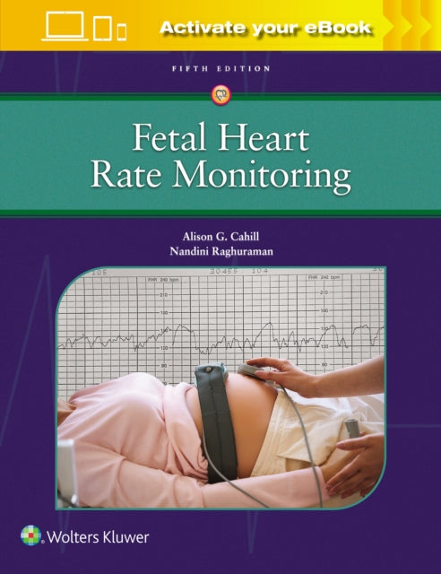 Book cover of: Fetal Heart Rate Monitoring. By: Alison Cahill
