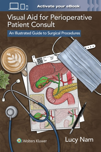 Book cover of: Visual Aid for Perioperative Patient Consult