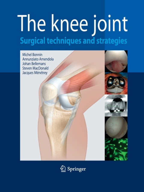 Book cover of: Knee Joint. By: Michel Bonnin