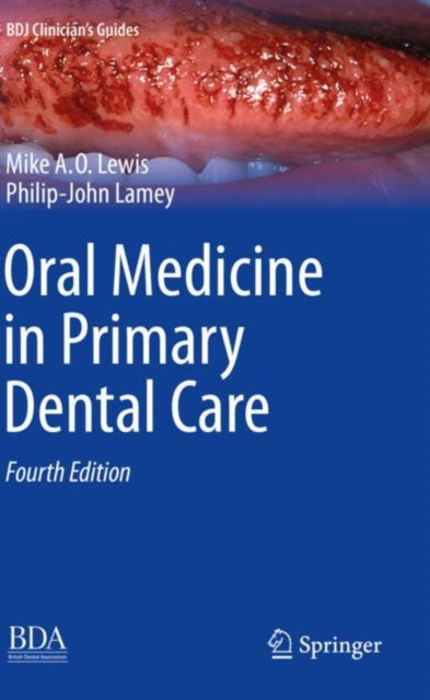 Book cover of: Oral Medicine in Primary Dental Care. By: Michael A. O. Lewis