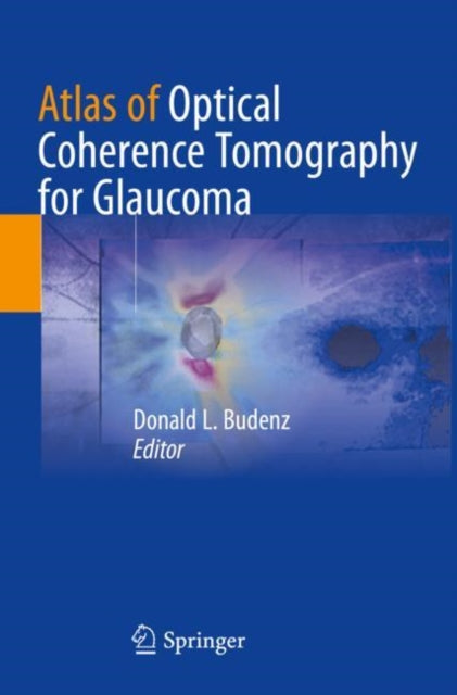 Book cover of: Atlas of Optical Coherence Tomography for Glaucoma. By: Donald L. Budenz