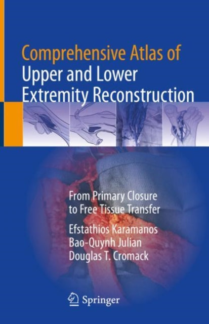 Book cover of: Comprehensive Atlas of Upper and Lower Extremity Reconstruction. By: Efstathios Karamanos