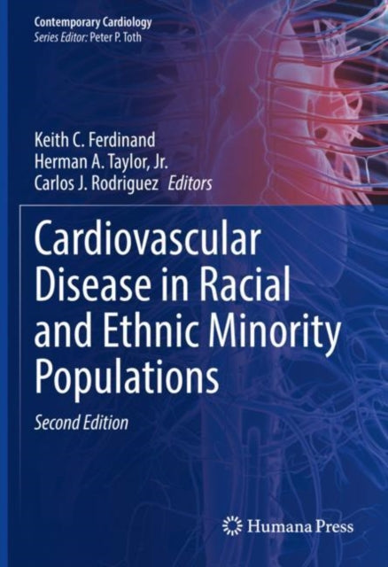 Book cover of: Cardiovascular Disease in Racial and Ethnic Minority Populations. By: Keith C. Ferdinand