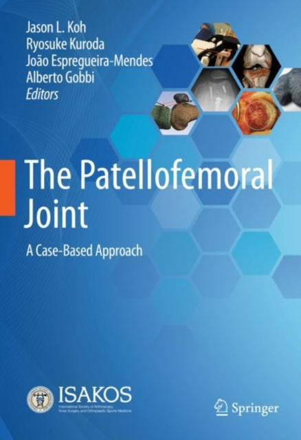 Book cover of: Patellofemoral Joint. By: Jason L. Koh