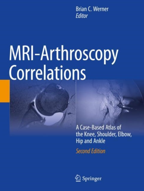 Book cover of: MRI-Arthroscopy Correlations. By: Brian C. Werner