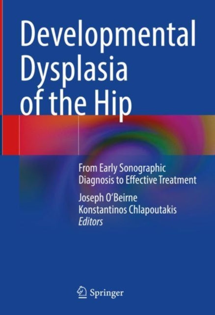 Book cover of: Developmental Dysplasia of the Hip. By: Joseph O'Beirne