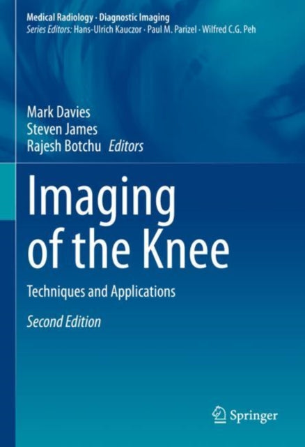 Book cover of: Imaging of the Knee. By: Mark Davies