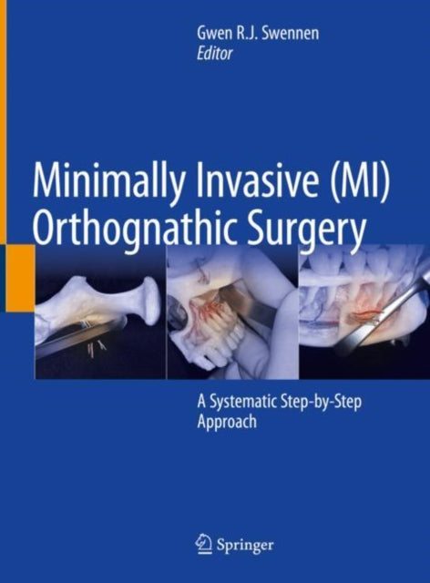 Book cover of: Minimally Invasive (MI) Orthognathic Surgery. By: Gwen R. J. Swennen
