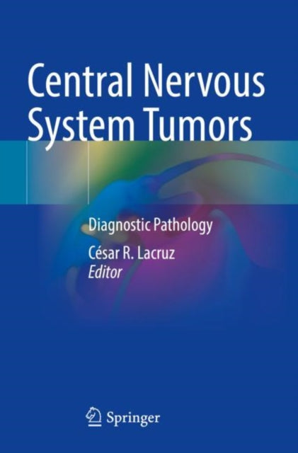 Book cover of: Central Nervous System Tumors