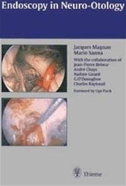 Book cover of: Endoscopy in Neuro-Otology and Skull Base Surgery (at)