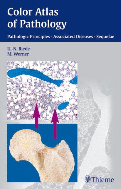 Book cover of: Color Atlas of Pathology