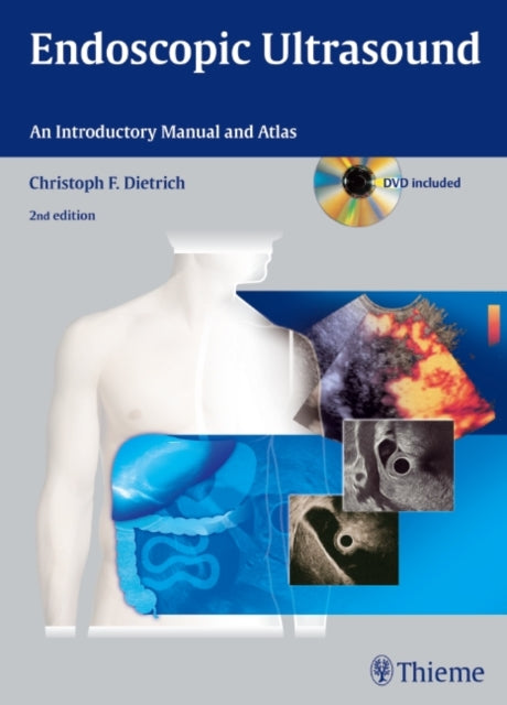 Book cover of: Endoscopic Ultrasound. By: Christoph Frank Dietrich