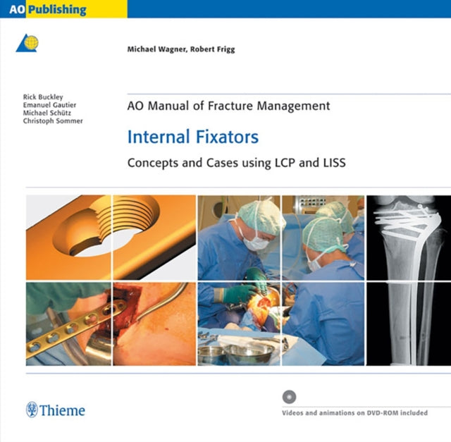 Book cover of: AO Manual of Fracture Management: Internal Fixators. By: Michael Wagner