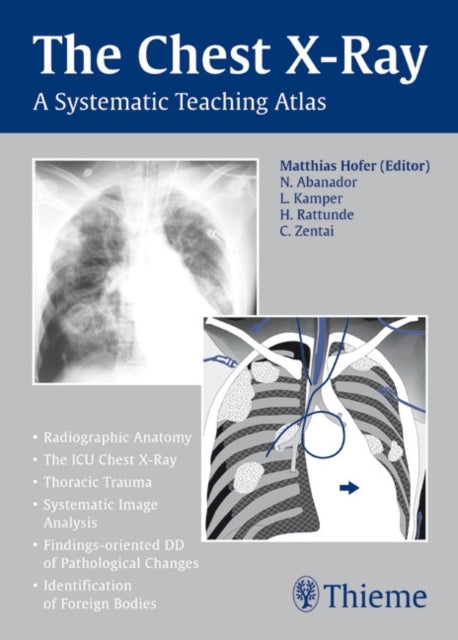 Book cover of: Chest X-Ray