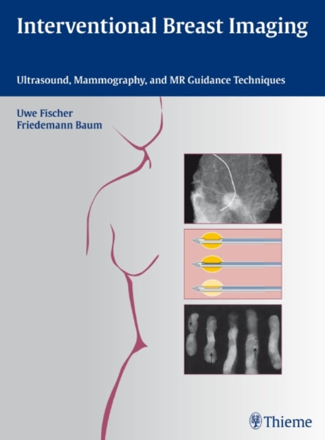 Book cover of: Interventional Breast Imaging. By: Uwe Fischer
