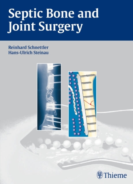 Book cover of: Septic Bone and Joint Surgery