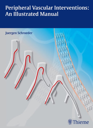 Peripheral Vascular Interventions: an Illustrated Manual