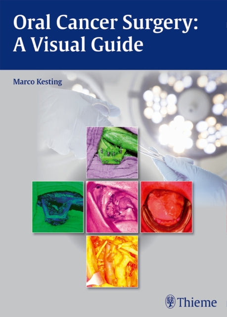 Book cover of: Oral Cancer Surgery. By: Marco R. Kesting