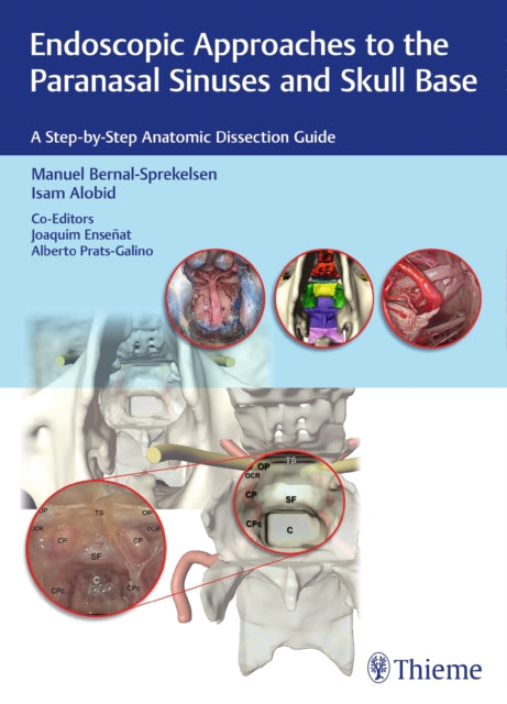 Book cover of: Endoscopic Approaches to the Paranasal Sinuses and Skull Base. By: Manuel Bernal-Sprekelsen