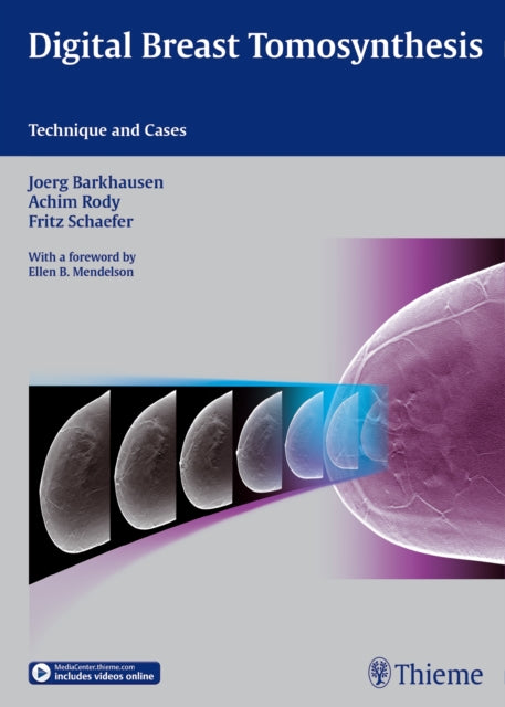 Book cover of: Digital Breast Tomosynthesis. By: Jörg Barkhausen