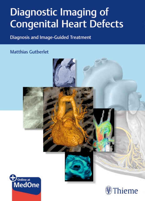 Book cover of: Diagnostic Imaging of Congenital Heart Defects. By: Matthias Gutberlet