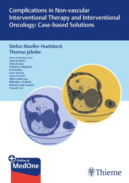 Book cover of: Complications in Non-vascular Interventional Therapy and Interventional Oncology: Case-based Solutions. By: Stefan Müller-Hülsbeck