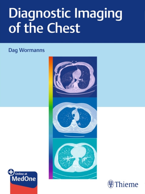 Book cover of: Diagnostic Imaging of the Chest. By: Dag Wormanns