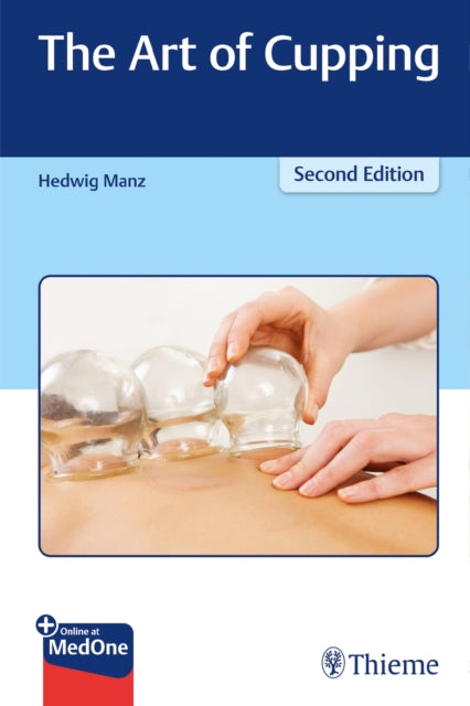 Book cover of: Art of Cupping. By: Hedwig Manz